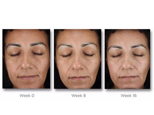 neostrata products for pigmentation