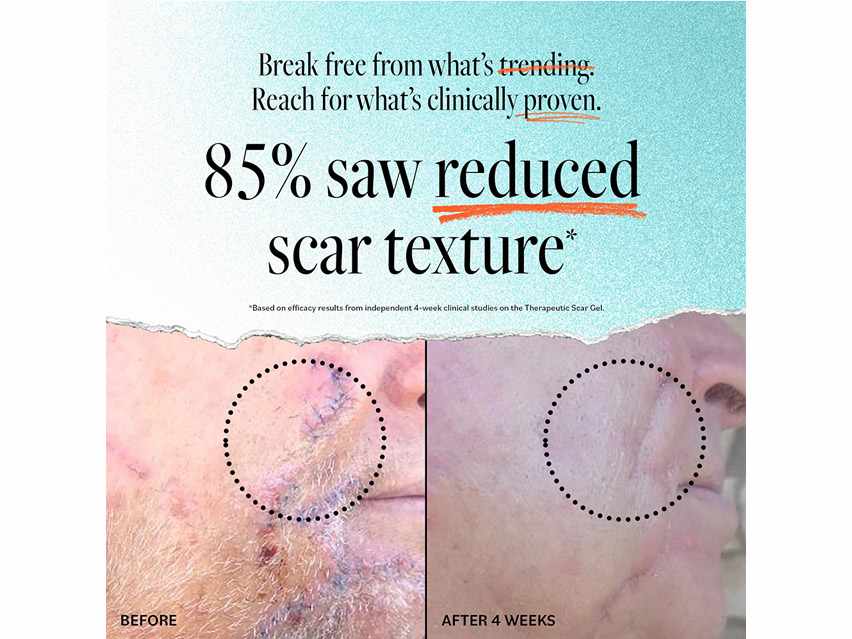 derma e Therapeutic Scar Gel