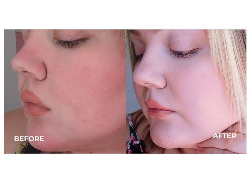 derma e Pure Biome Balancing Cleanser