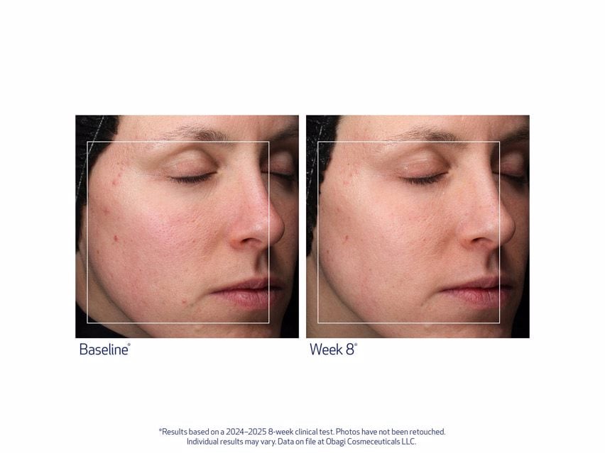 Obagi Retinol + PHA Refining Night Cream