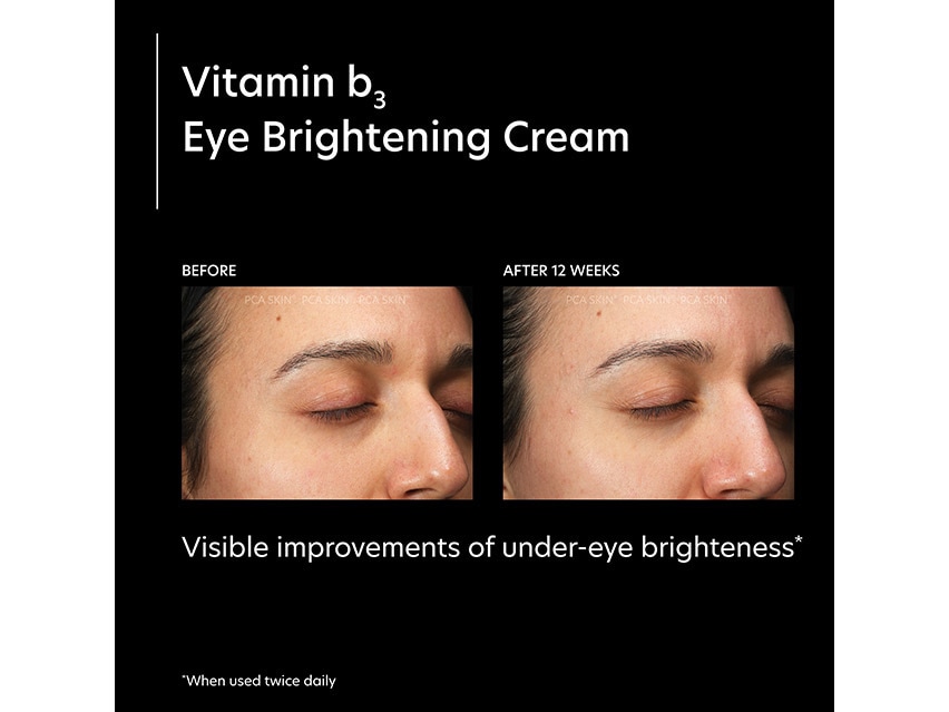 PCA SKIN Vitamin B3 Eye Brightening Cream