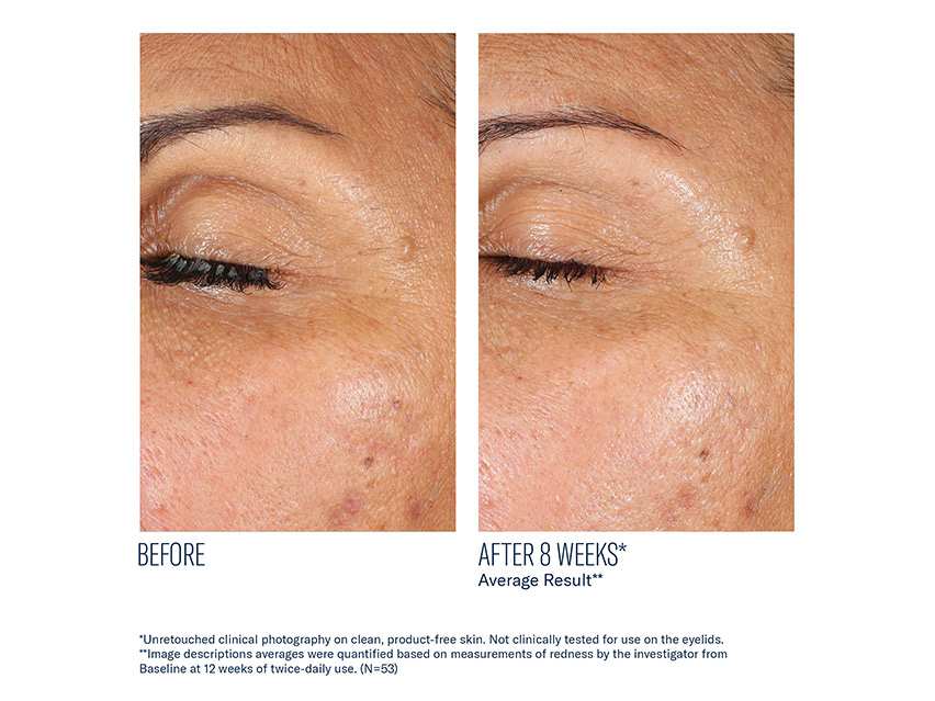 skinbetter science EyeMax AlphaRet Overnight Cream