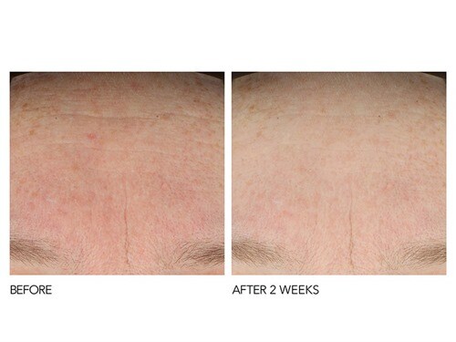 dennis gross super serum