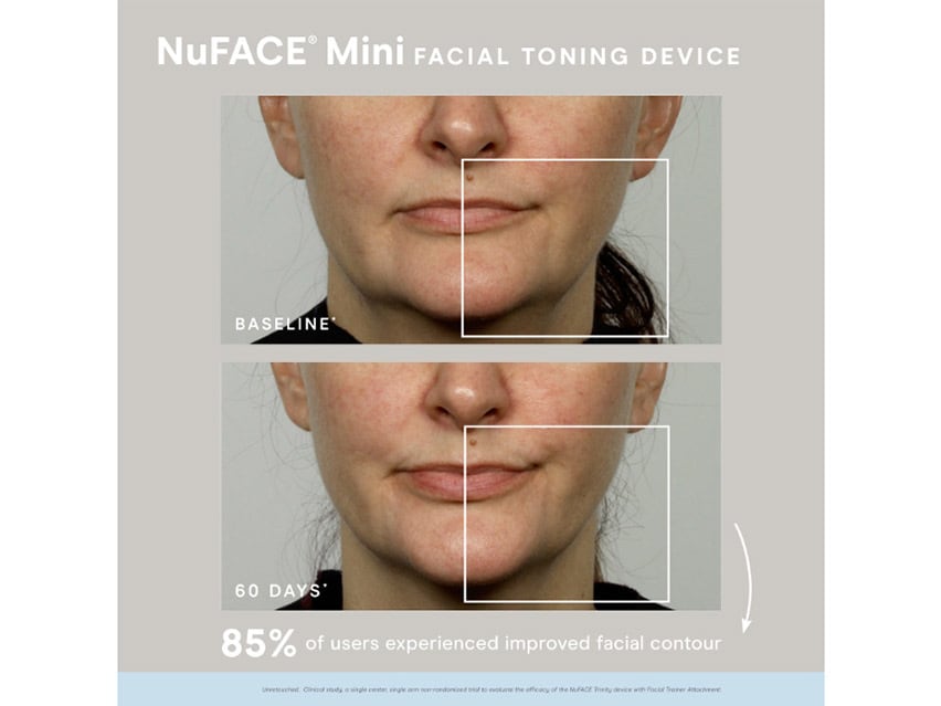 NuFACE Mini Supercharged Skincare Routine - Limited Edition