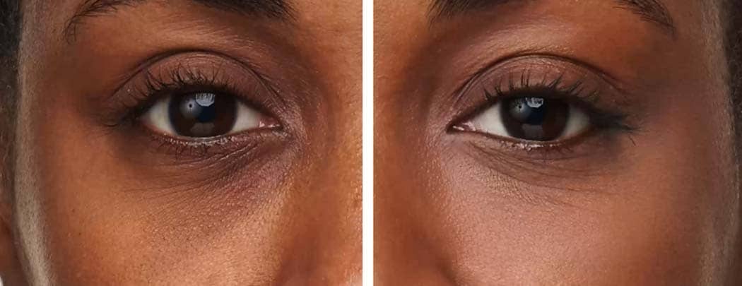 jane iredale Enlighten Plus Under-Eye Concealer Before & After