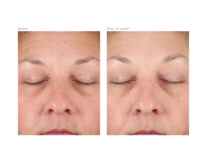Revision Skincare D·E·J Face Cream