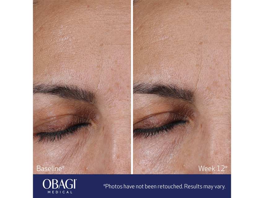 Obagi ELASTIderm Advanced Filler Concentrate