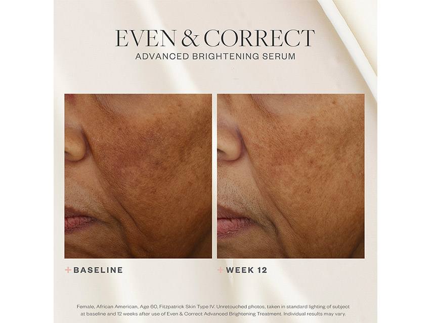 SkinMedica Even &amp; Correct Advanced Brightening Treatment Serum