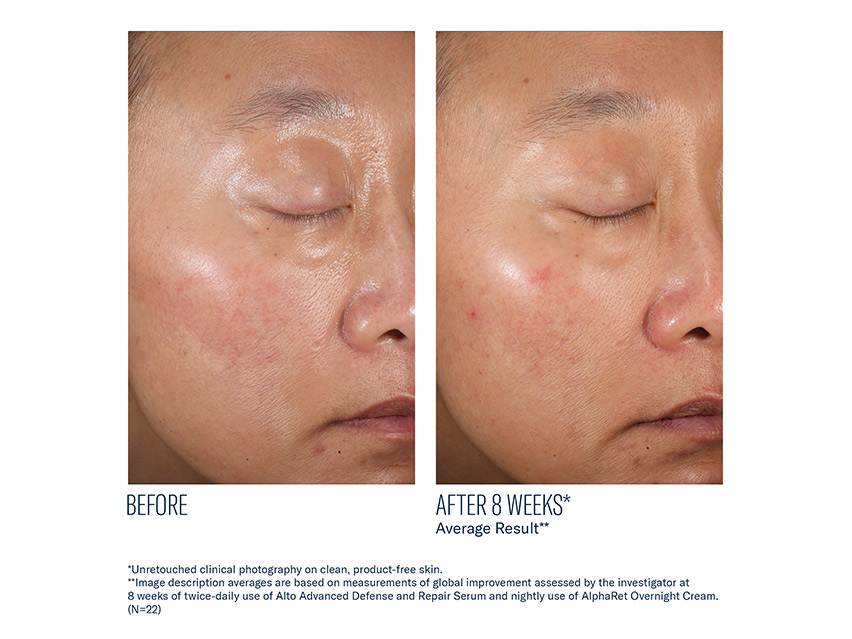 skinbetter science A-Team Duo Kit