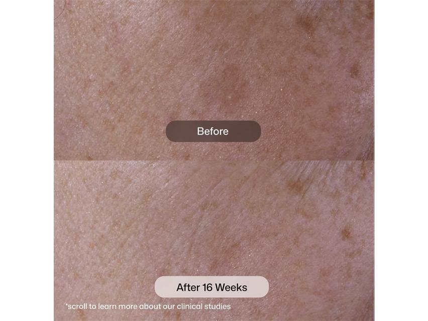 Revision Skincare Advanced Pigment Corrector+