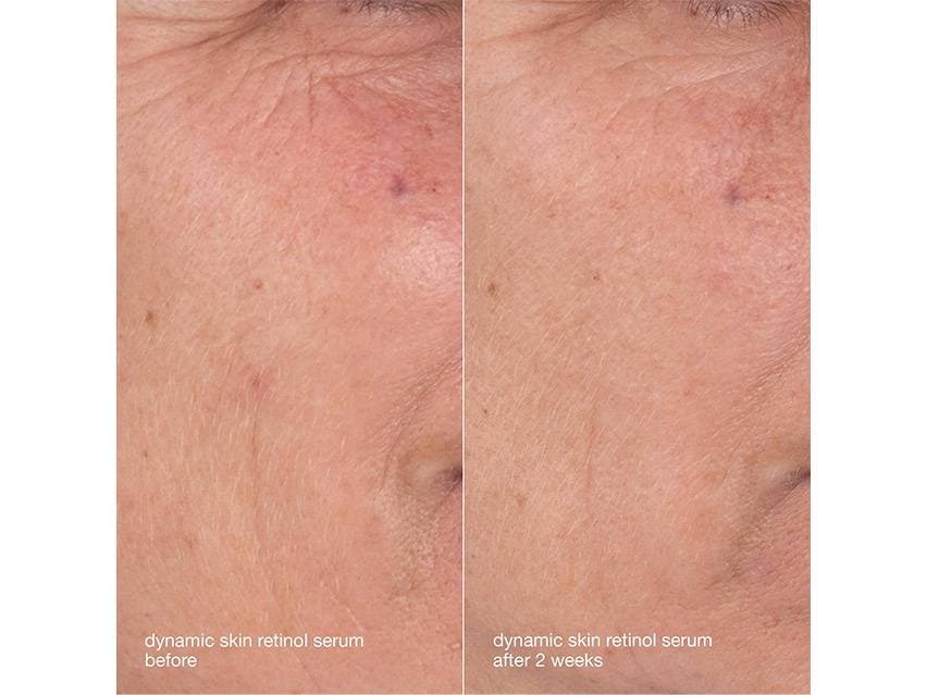 Dermalogica Dynamic Skin Aging Solutions