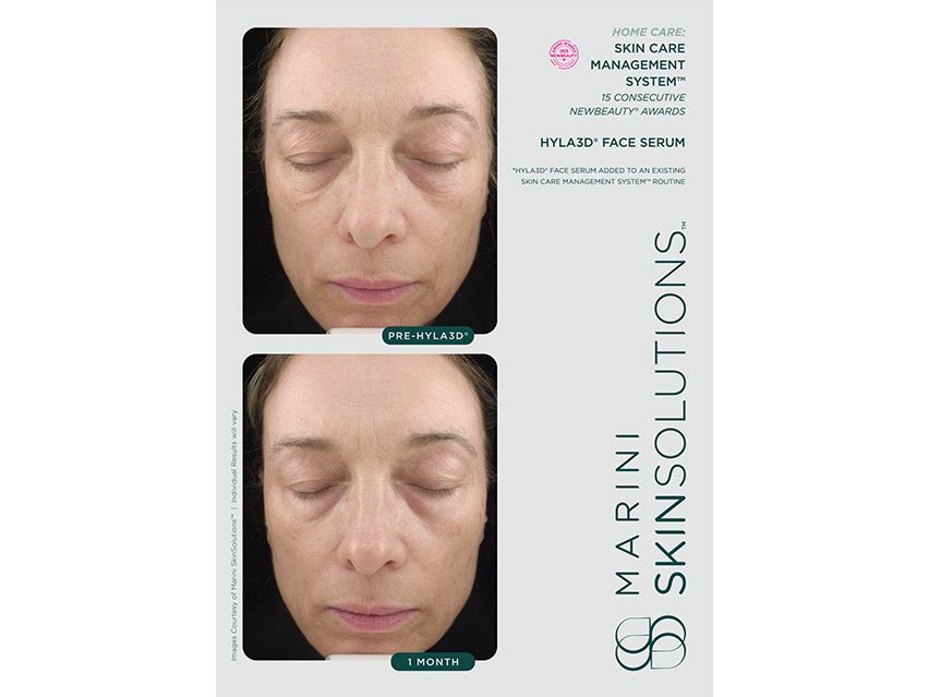 Marini SkinSolutions Hyla3D&#174; Face Serum Hyaluronic Acid Complex