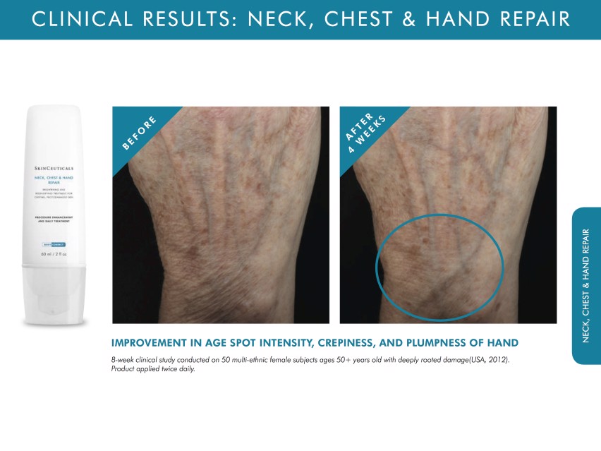 SkinCeuticals Neck, Chest & Hand Repair Cream