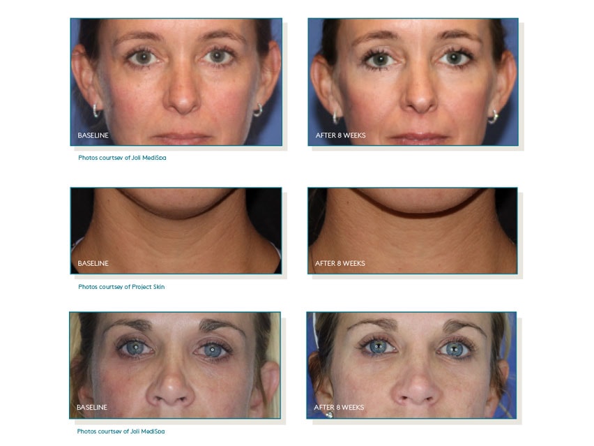 Colorescience PEP UP Collagen Renewal Face & Neck Treatment