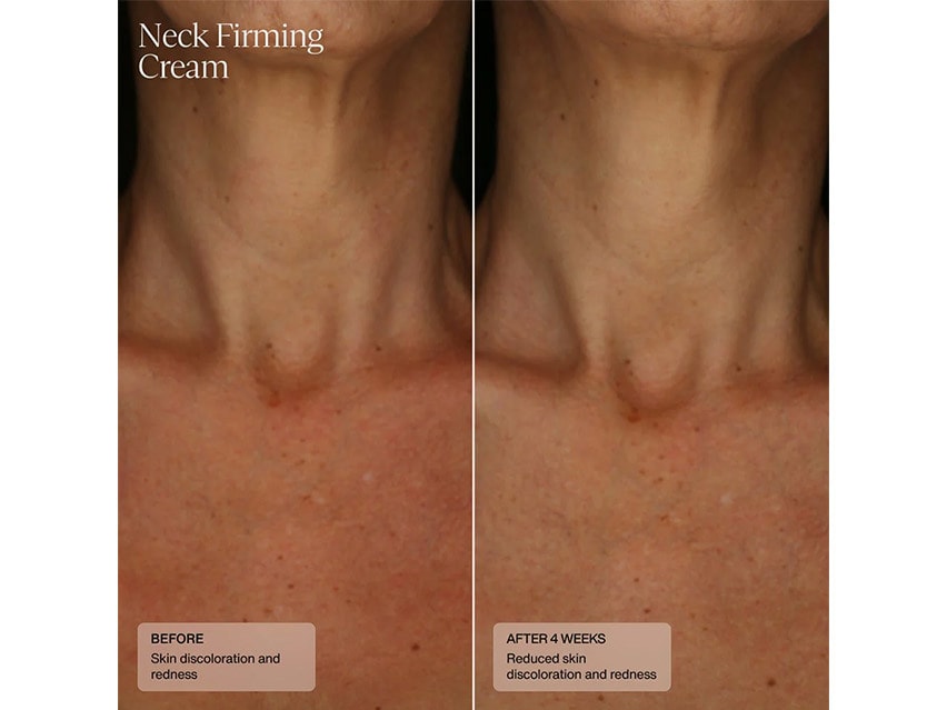 Senté Neck Firming Cream