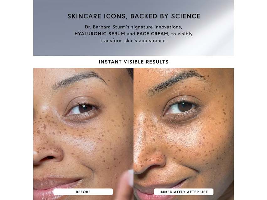 Dr. Barbara Sturm The Icons Set