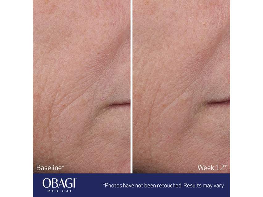 Obagi ELASTIderm Advanced Filler Concentrate