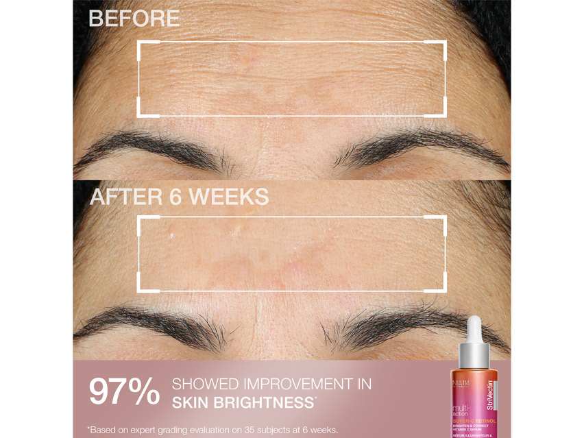 StriVectin Clinically Proven Minis - Limited Edition