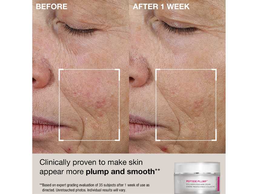 StriVectin Anti-Wrinkle Plump, Smooth &amp; Protect Kit - Limited Edition