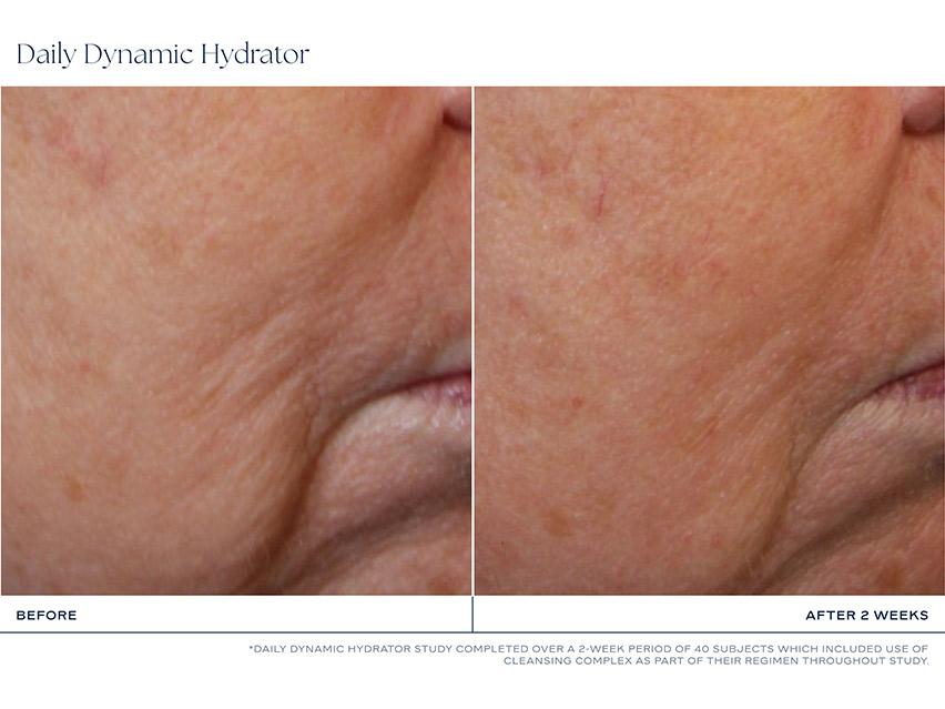 iS CLINICAL Daily Dynamic Hydrator