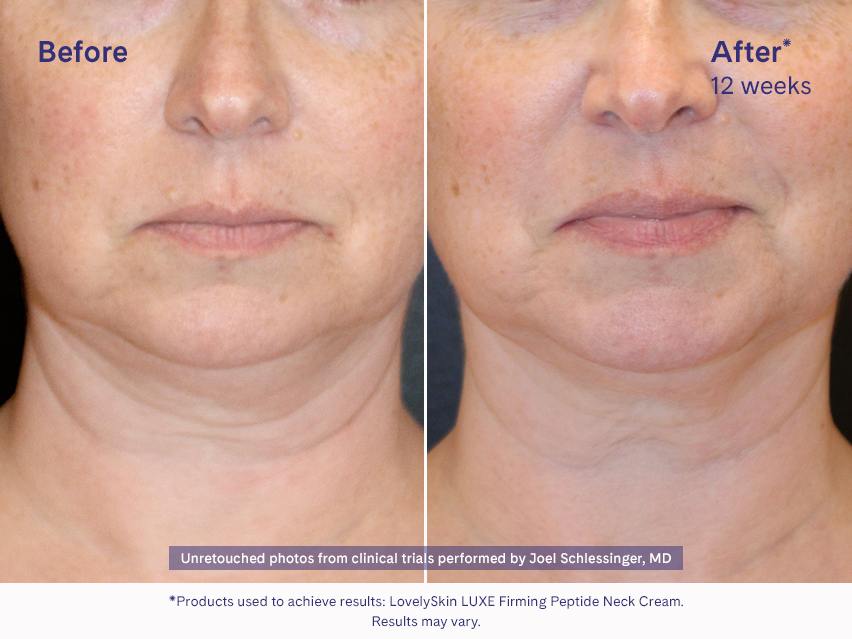 LovelySkin LUXE Firming Peptide Neck Cream