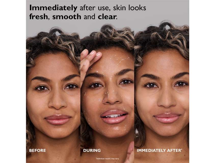 Peter Thomas Roth FIRMx Peeling Gel Exfoliant