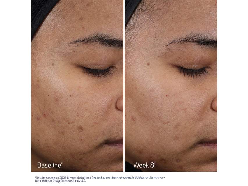 Obagi CLENZIderm M.D. Resurfacing Multi-Acid Peel Pads