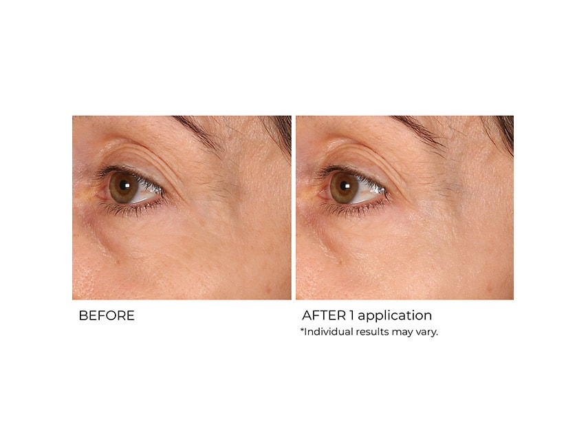 NassifMD Dermaceuticals™ Wrinkle Blur Targeted Treatment