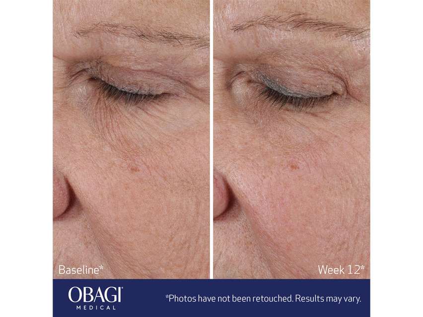 Obagi ELASTIderm Lift Up &amp; Sculpt Facial Moisturizer