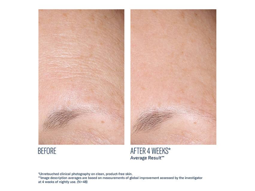 skinbetter science AlphaRet Overnight Cream