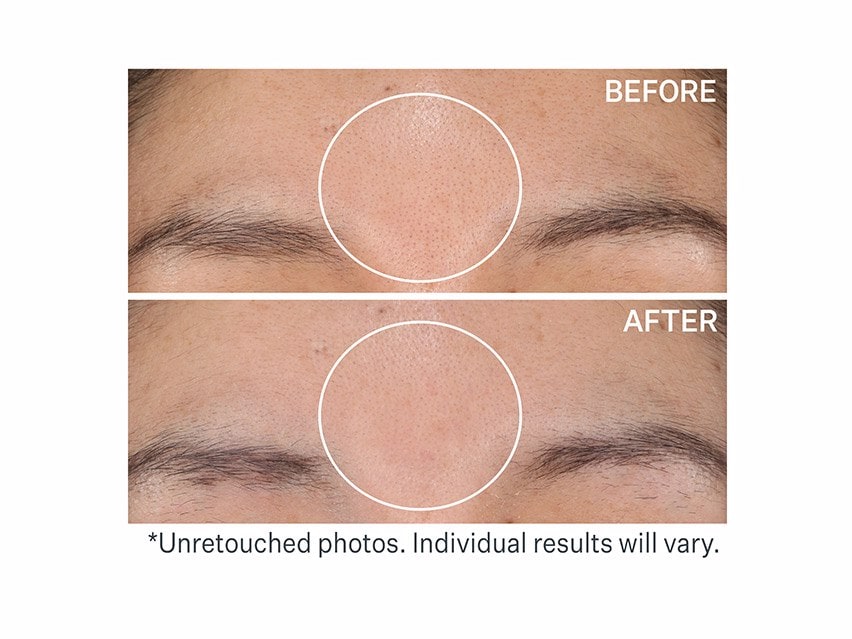 StriVectin Advanced Resurfacing Daily Reveal™ Exfoliating Pads