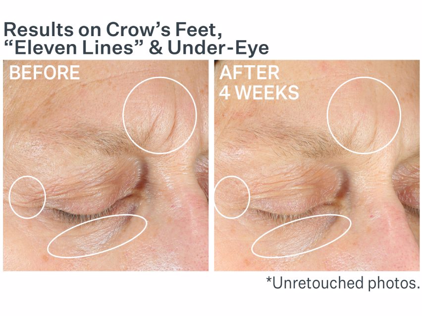 strivectin eye concentrate for wrinkles göz kremi