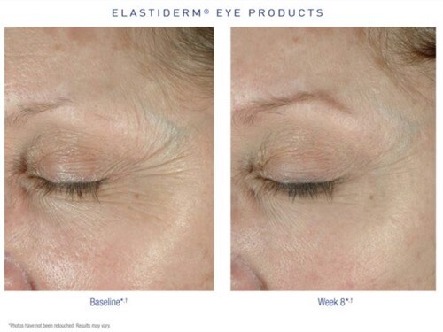 obagi medical elastiderm eye treatment cream stores