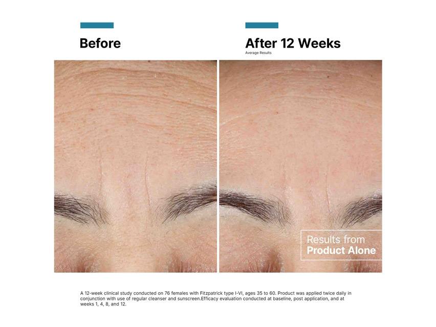 SkinCeuticals Advanced RGN-6 Aesthetic Recovery Cream