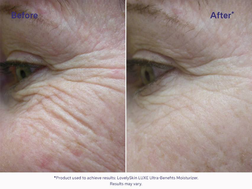 LovelySkin LUXE Ultra-Benefits Moisturizer