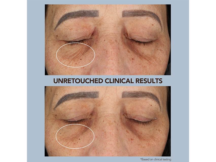 FOREO SUPERCHARGED Microcurrent Facelift Set