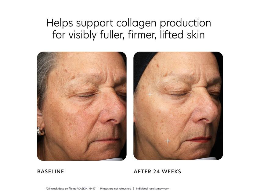 PCA SKIN MGF Age Renewal Cream