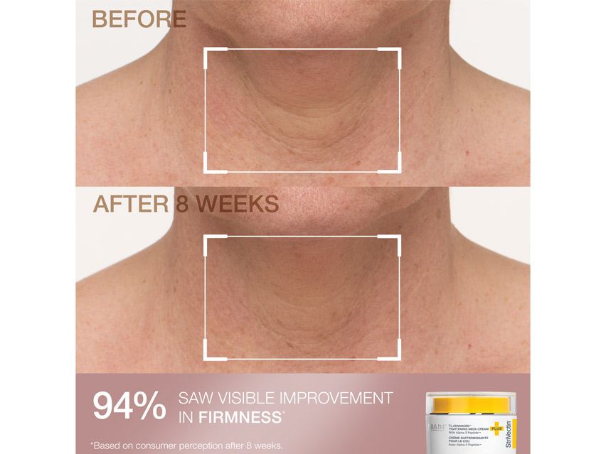 StriVectin Clinically Proven Minis - Limited Edition