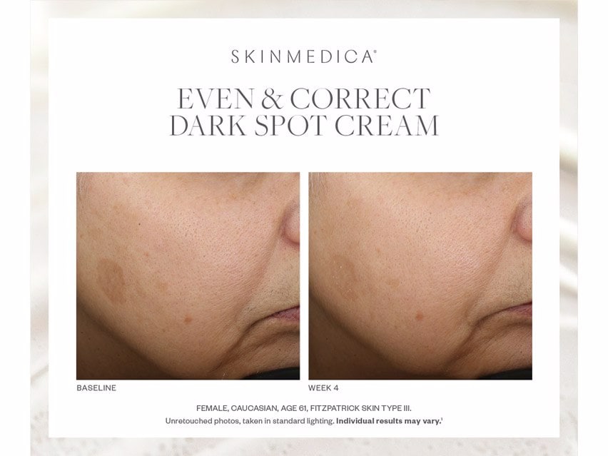 SkinMedica Even & Correct Dark Spot Cream