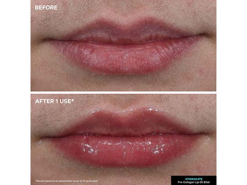 Kate Somerville HydraKate Lip Oil Elixir