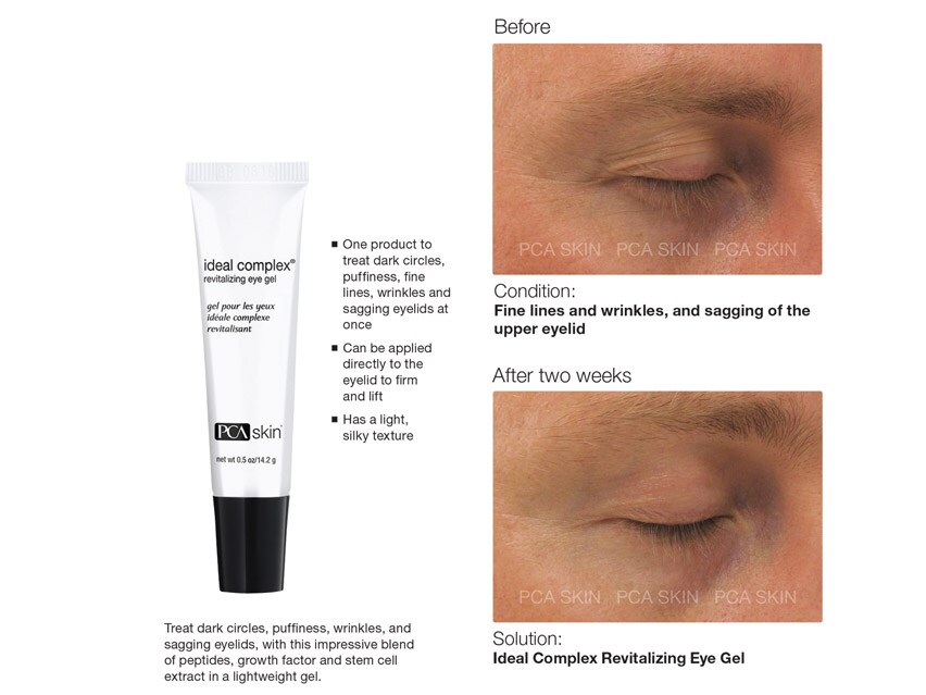 ideal complex restorative eye cream