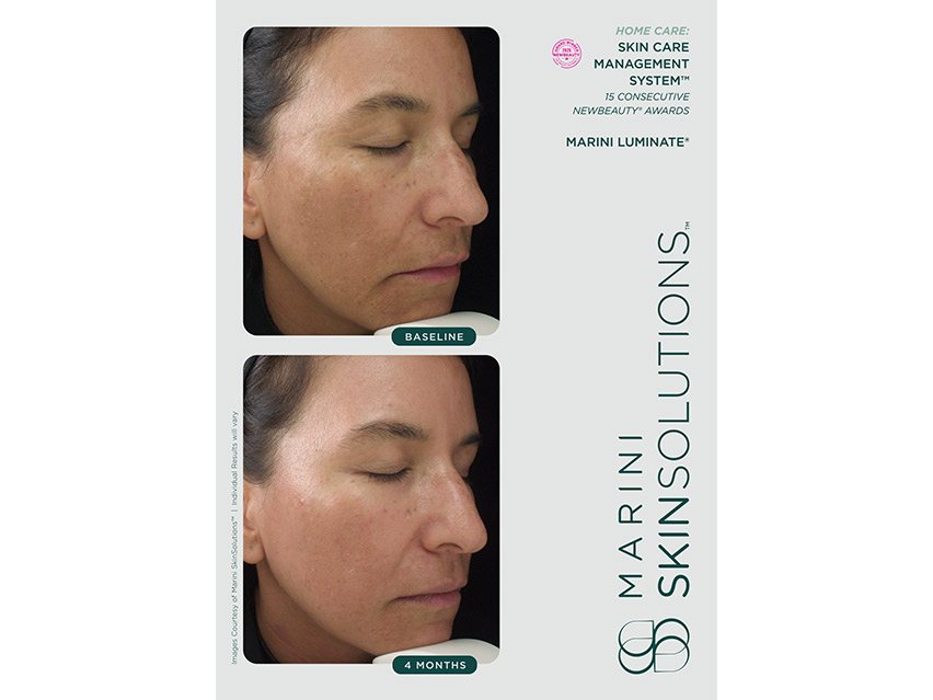 Marini SkinSolutions Marini Luminate Face Lotion | LovelySkin