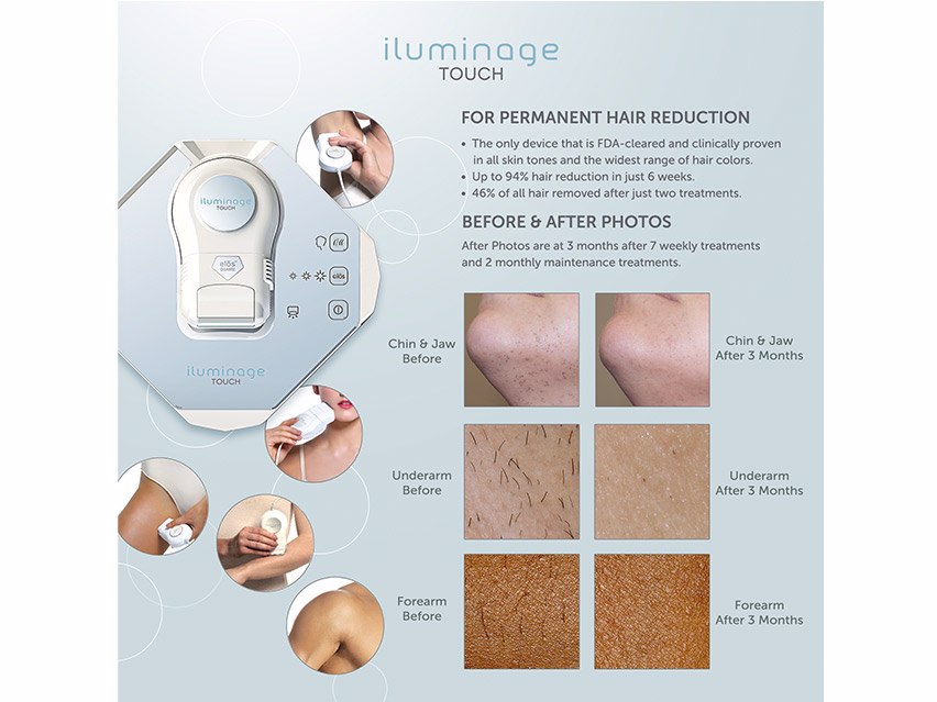 iluminage Touch 4Ever Home Permanent Hair Removal IPL & Radio Frequency System