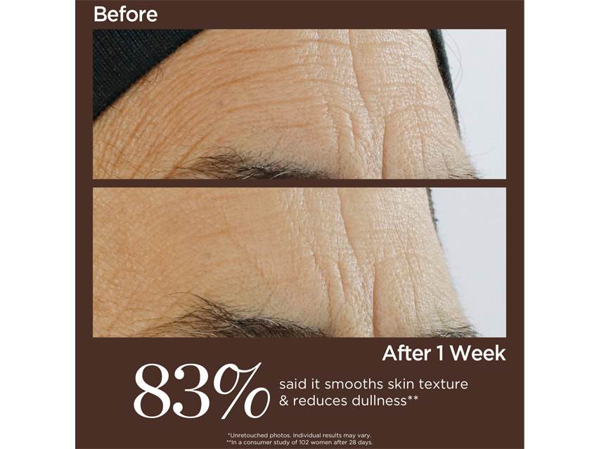 Perricone MD High Potency Triple Retinol Renewal Serum