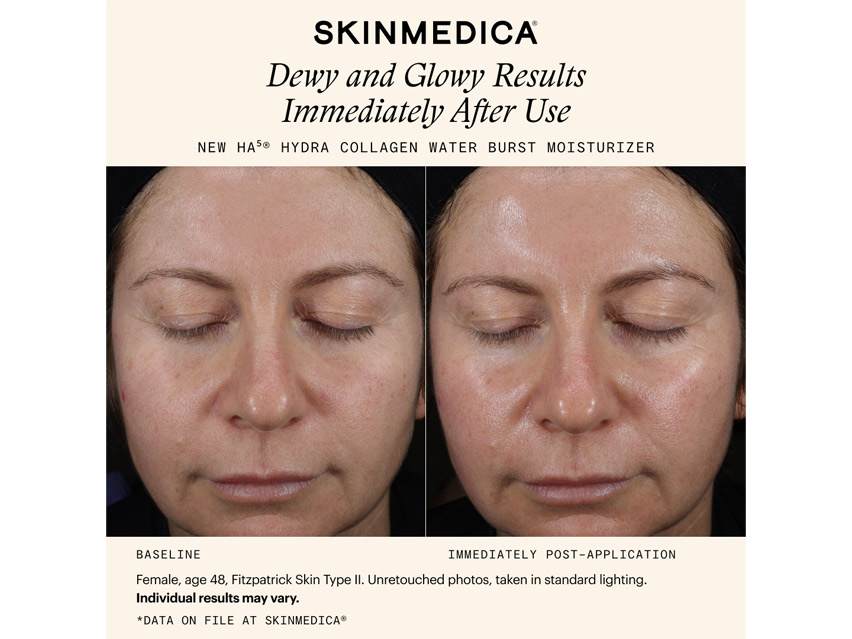 SkinMedica HA5 Hydra Collagen Water Burst Moisturizer