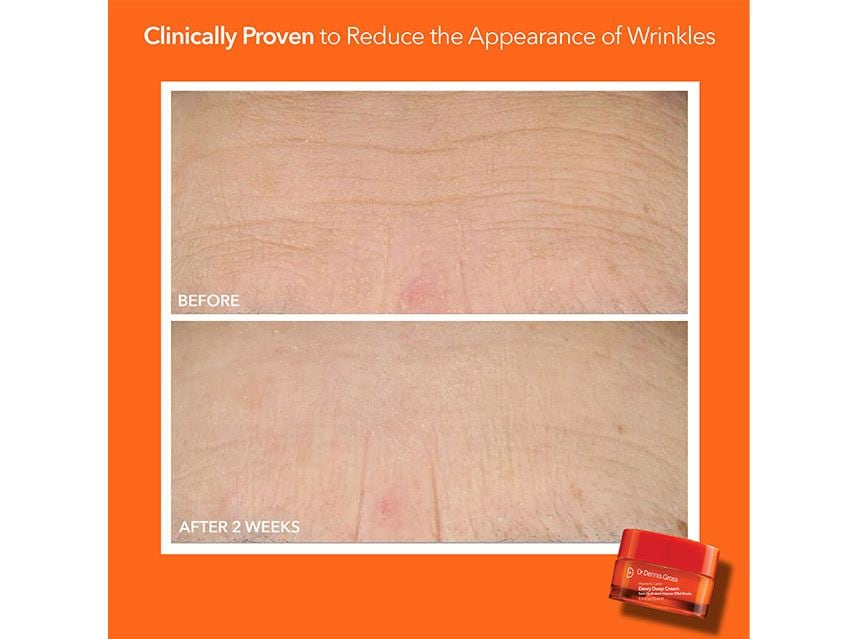 Dr. Dennis Gross Skincare Radiant, Smooth &amp; Firm Extra Strength Daily Peel Kit - Limited Edition