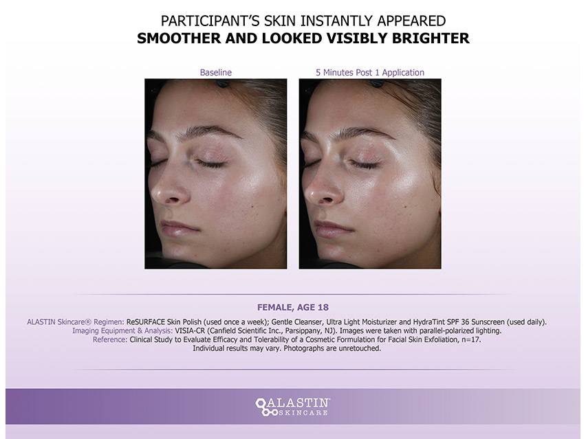 ALASTIN Skincare ReSURFACE Skin Polish