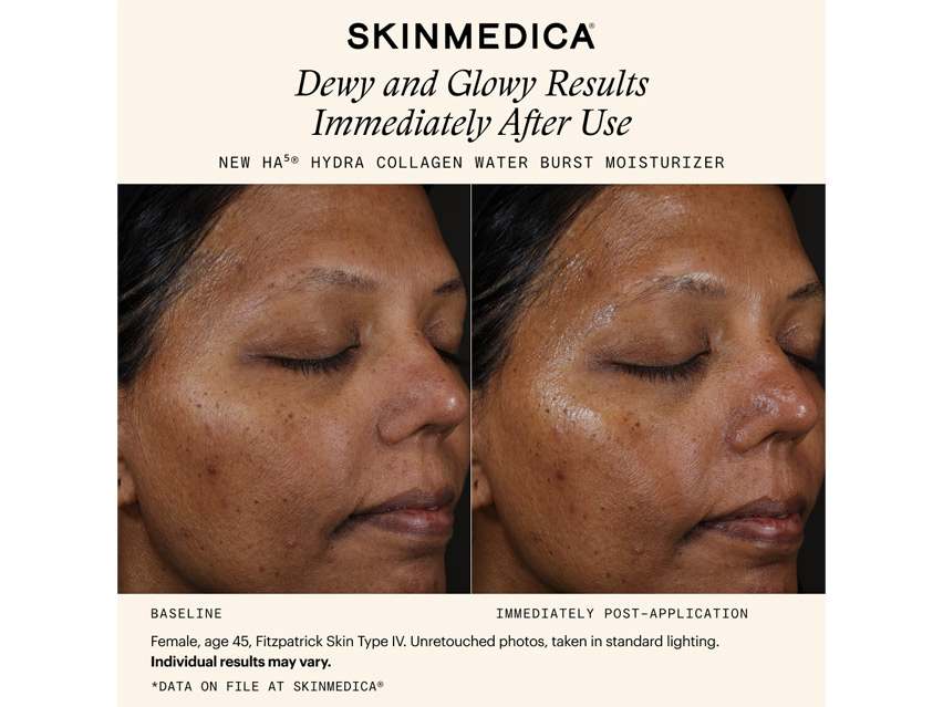SkinMedica HA5 Hydra Collagen Water Burst Moisturizer