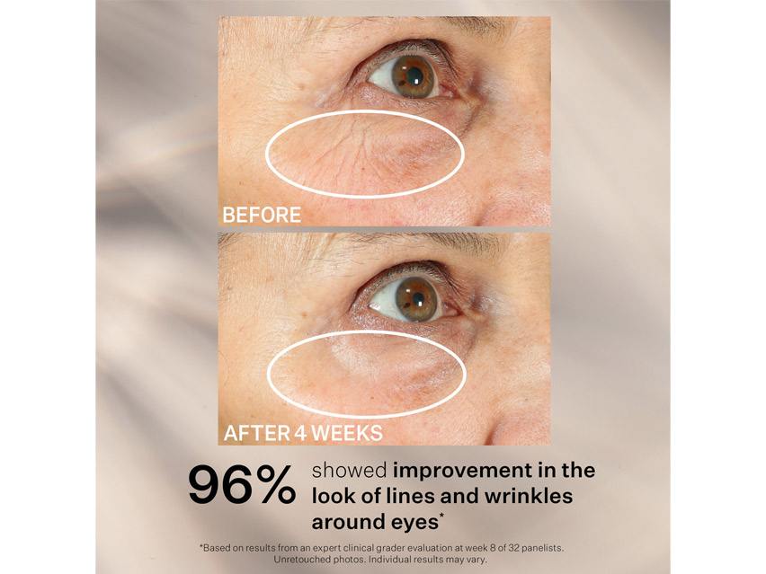 StriVectin Tighten & Lift Peptight™ 360° Tightening Eye