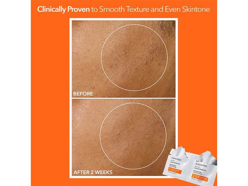 Dr. Dennis Gross Skincare Alpha Beta® Universal Daily Peel